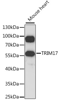 TRIM17 Polyclonal Antibody (E-AB-91303)