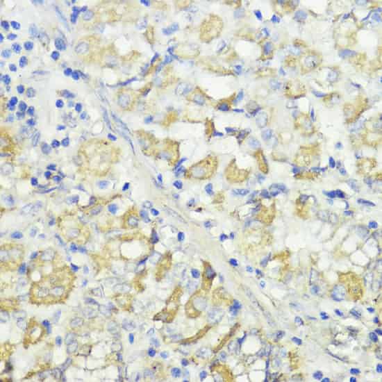 CTSB Polyclonal Antibody (E-AB-65718)