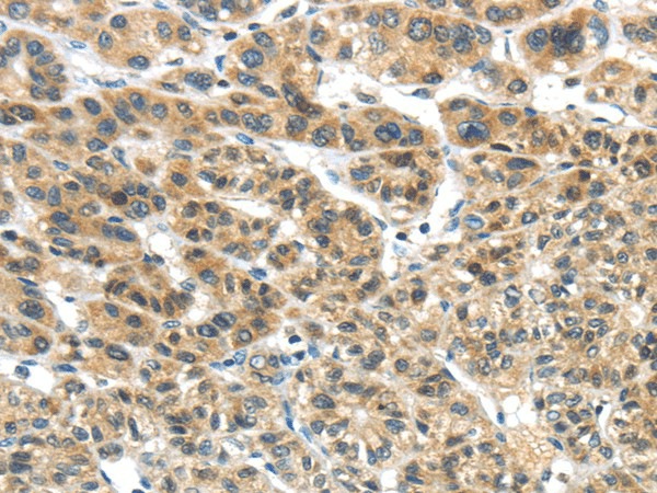 TKTL1 Polyclonal Antibody (E-AB-17097)