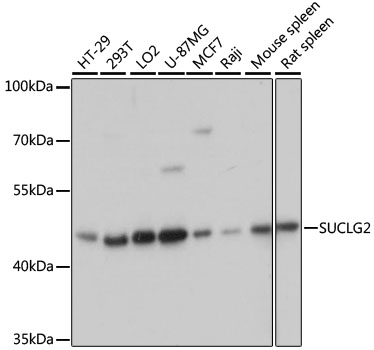 (KO Validated) SUCLG2 Polyclonal Antibody (E-AB-65605)