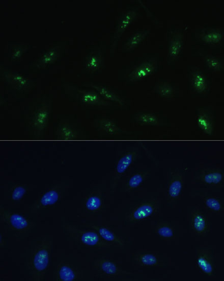 HNF4G Polyclonal Antibody (E-AB-66671)
