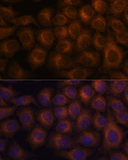 VAV3 Polyclonal Antibody (E-AB-65294)