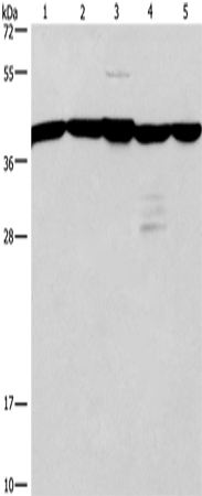 GNA13 Polyclonal Antibody (E-AB-10331)