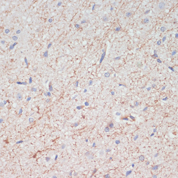 SLC6A3 Polyclonal Antibody (E-AB-66469)