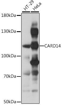 CARD14 Polyclonal Antibody (E-AB-91581)