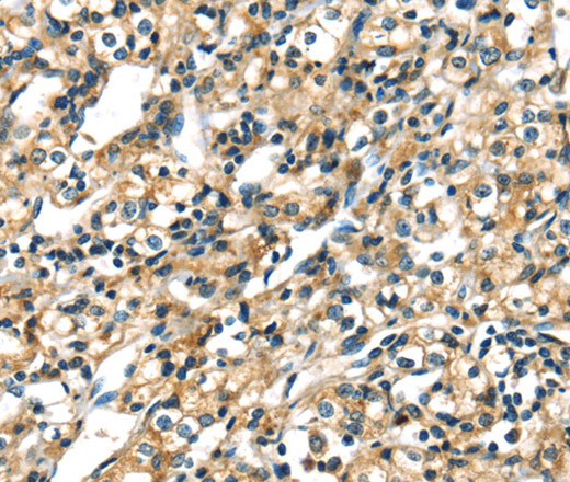 CK-17 Polyclonal Antibody (E-AB-13909)