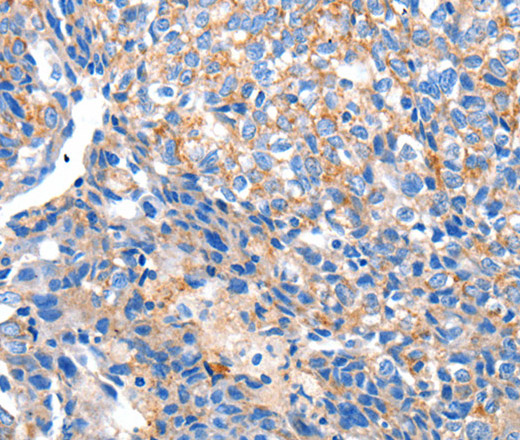 HCN2 Polyclonal Antibody (E-AB-15709)