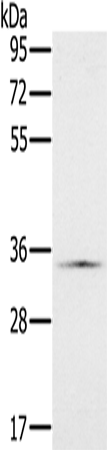 NDUFA9 Polyclonal Antibody (E-AB-11423)