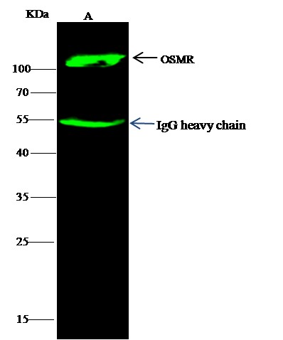 OSMR/IL31RB Monoclonal Antibody (AN200030P)
