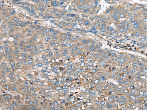 GULP1 Polyclonal Antibody (E-AB-17787)