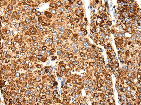 CACNG5 Polyclonal Antibody (E-AB-19655)