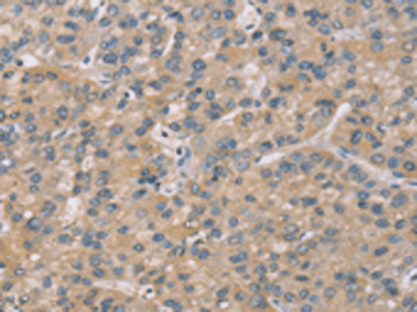 ZBTB3 Polyclonal Antibody (E-AB-53227)