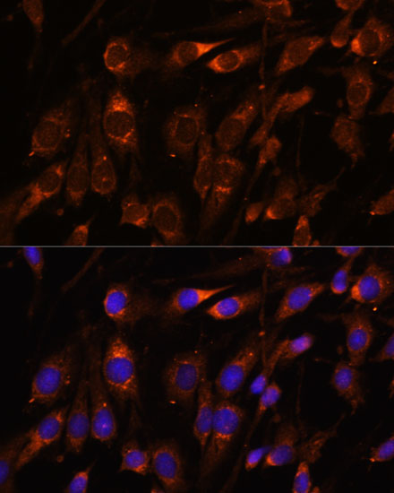FARSB Polyclonal Antibody (E-AB-65289)