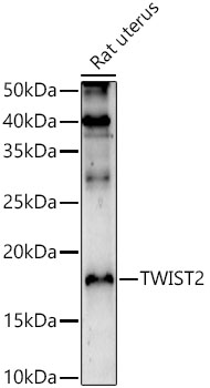 TWIST2 Polyclonal Antibody (E-AB-92658)