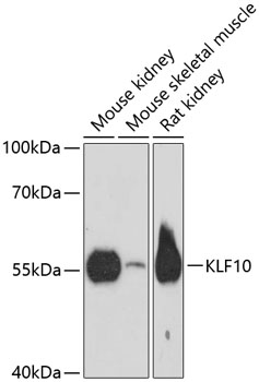 KLF10 Polyclonal Antibody (E-AB-64491)