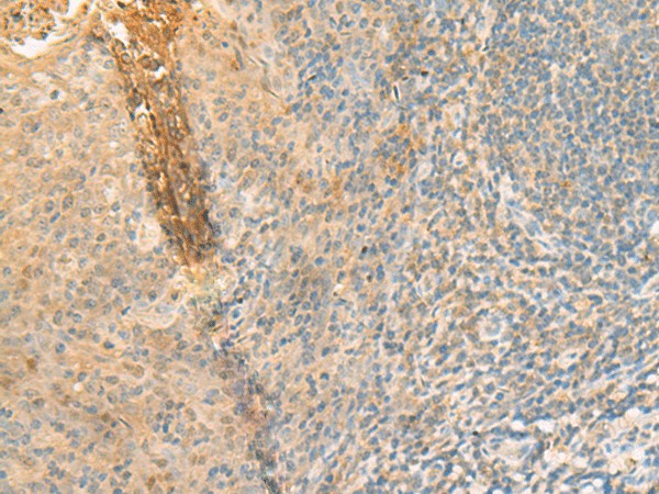 GPT2 Polyclonal Antibody (E-AB-19961)