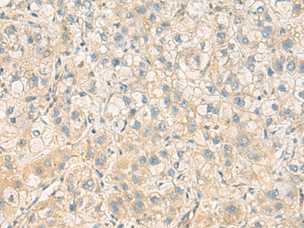 PPM1M Polyclonal Antibody (E-AB-19190)