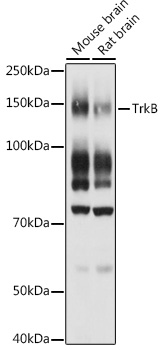 TrkB Polyclonal Antibody (E-AB-93271)