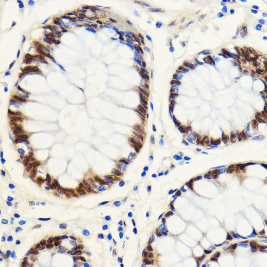 SNIP1 Polyclonal Antibody (E-AB-66926)