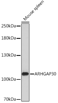 ARHGAP30 Polyclonal Antibody (E-AB-91936)
