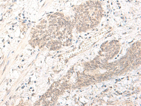 PBXIP1 Polyclonal Antibody (E-AB-52665)