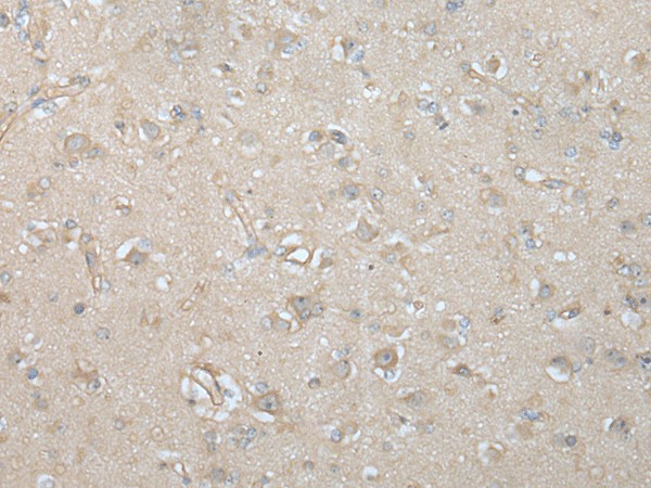 VILL Polyclonal Antibody (E-AB-52420)