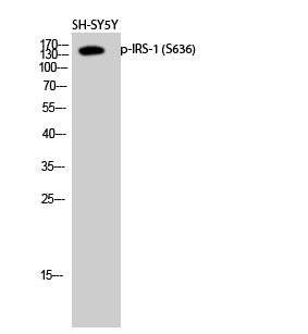 Phospho-IRS1 (Ser636) Polyclonal Antibody (E-AB-20908)