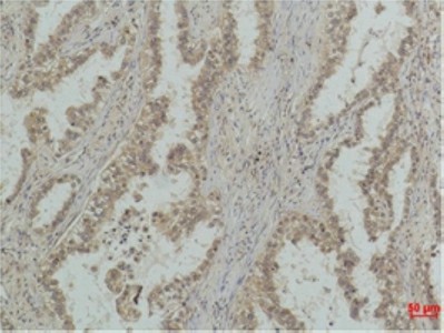 Mono-Methyl-P53 (Lys370) Monoclonal Antibody (E-AB-50004)