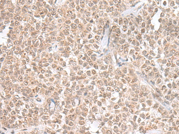 THAP12 Polyclonal Antibody (E-AB-18778)