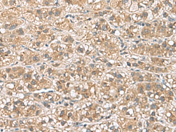 PHLDA3 Polyclonal Antibody (E-AB-53028)