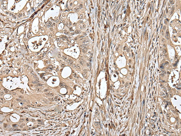 UTP3 Polyclonal Antibody (E-AB-52450)