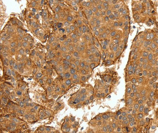 COL4A1 Polyclonal Antibody (E-AB-12331)