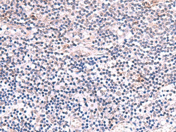 INPP5K Polyclonal Antibody (E-AB-52958)