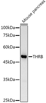 THRB Polyclonal Antibody (E-AB-66591)
