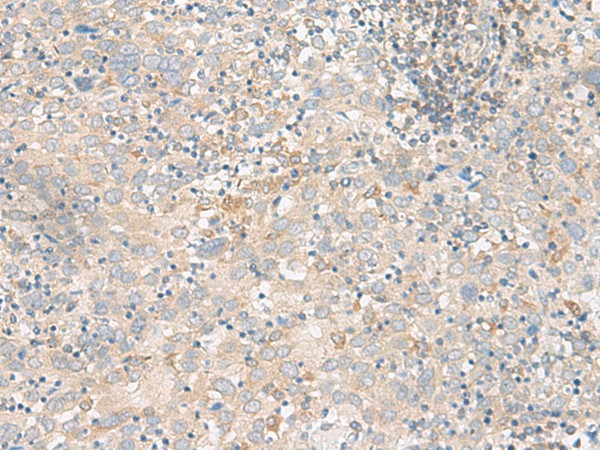 FGF13 Polyclonal Antibody (E-AB-19868)