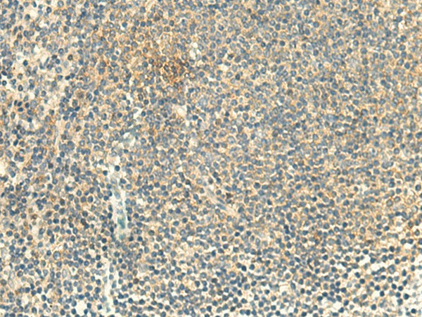 ALPK1 Polyclonal Antibody (E-AB-52176)