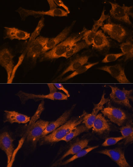RPL36AL Polyclonal Antibody (E-AB-64989)