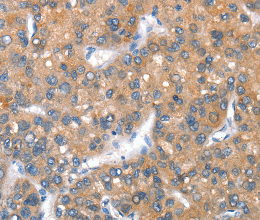 CD238 Polyclonal Antibody (E-AB-14797)
