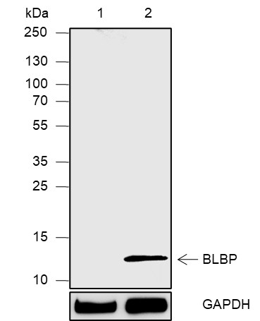 Recombinant FABP7 Monoclonal Antibody (AN301861L)