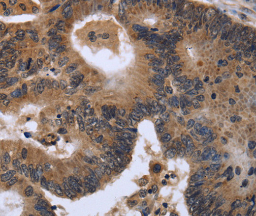 FGF21 Polyclonal Antibody (E-AB-15031)