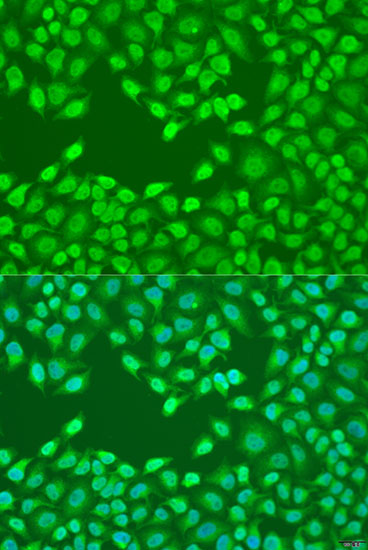 FZD4 Polyclonal Antibody (E-AB-66429)