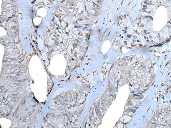 ZNF703 Polyclonal Antibody (E-AB-53533)