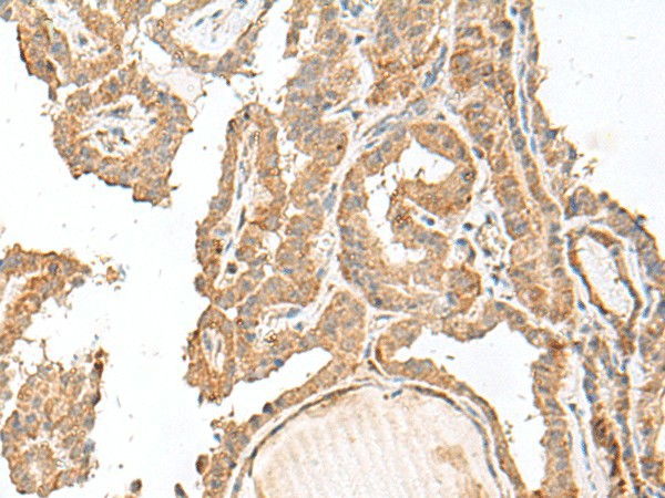 GART Polyclonal Antibody (E-AB-17989)