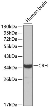 CRH Polyclonal Antibody (E-AB-65809)