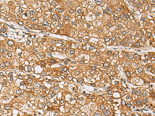 DCAF12 Polyclonal Antibody (E-AB-19783)