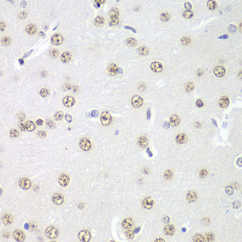 PRMT5 Polyclonal Antibody (E-AB-60325)