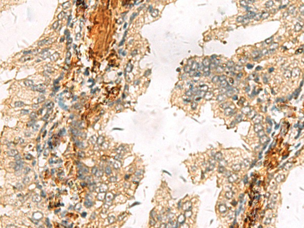 ACTC1 Polyclonal Antibody (E-AB-52617)