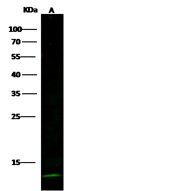 Recombinant Cystatin A/CSTA Monoclonal Antibody (AN300338P)