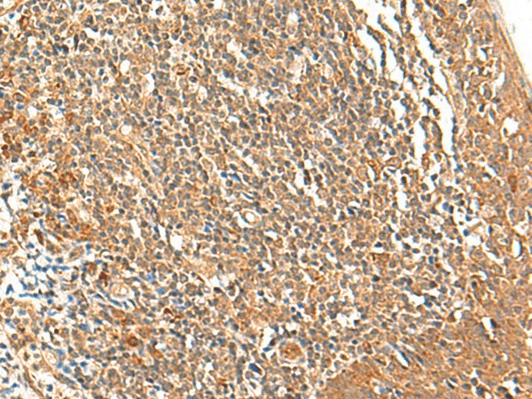 TSHB Polyclonal Antibody (E-AB-17957)