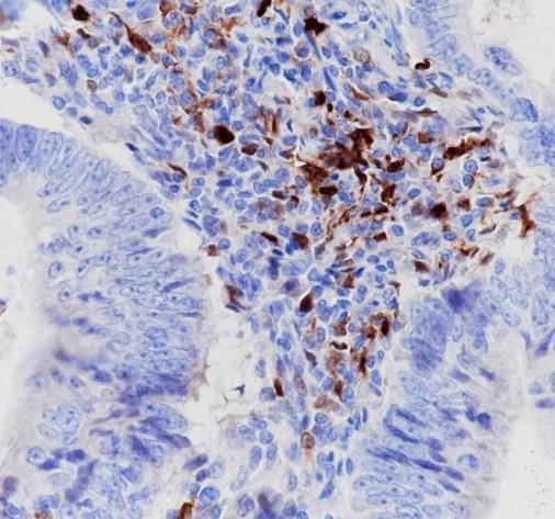 Recombinant IDO1 Monoclonal Antibody (AN301561L)